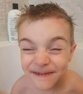 harley in the bath smiling intensely showing pointed teeth