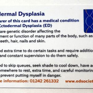 Ectodermal Dysplasia Alert Card