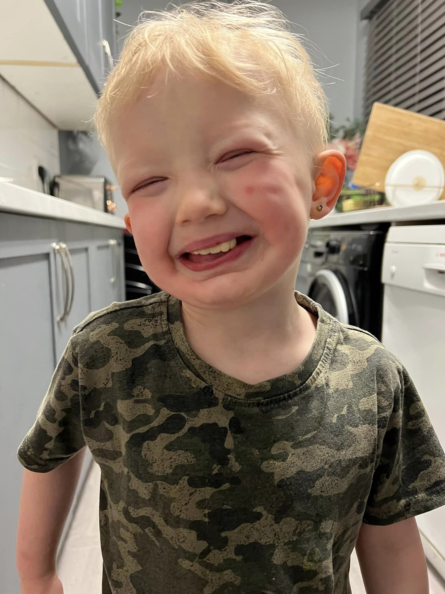 Lower and upper teeth diagram